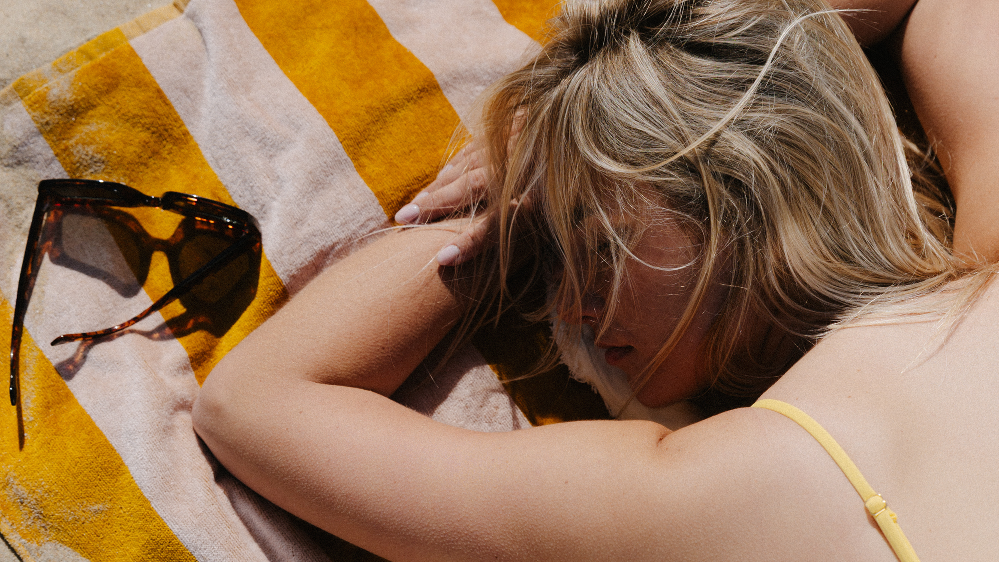 De ultieme aftersun tips: kalmeer je huid na een dag in de zon