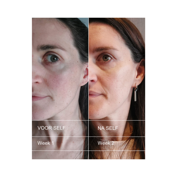 CALMING SKIN SET - with free body butter